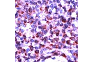 Human tonsil stained with Anti-Bak antibody (BAK1 anticorps  (N-Term))