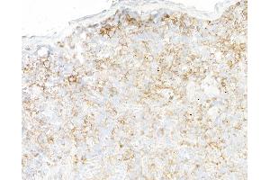 Immunohistochemistry (IHC) image for anti-Ectonucleoside Triphosphate diphosphohydrolase 1 (ENTPD1) (AA 300-350) antibody (ABIN7795686) (Recombinant CD39 anticorps  (AA 300-350))