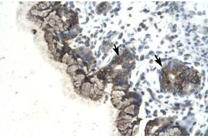 Human Stomach (PARP3 anticorps  (C-Term))