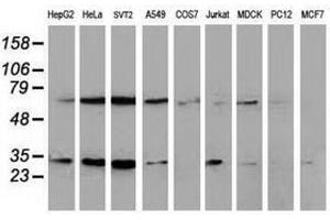 Image no. 4 for anti-Synovial Sarcoma, X Breakpoint 1 (SSX1) antibody (ABIN1501157) (SSX1 anticorps)
