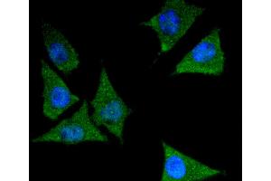 SH-SY-5Y cells were stained with 14-3-3 epsilon (2E2) Monoclonal Antibody  at [1:200] incubated overnight at 4C, followed by secondary antibody incubation, DAPI staining of the nuclei and detection.