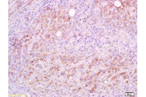 Formalin-fixed and paraffin embedded mouse lymphoma tissue labeled with Anti-CD5L/Api6 Polyclonal Antibody, Unconjugated (ABIN740985) at 1:200 followed by conjugation to the secondary antibody and DAB staining (CD5L anticorps  (AA 221-347))