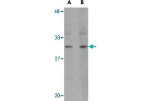 Western blot analysis of RASD2 in human colon tissue lysate with RASD2 polyclonal antibody  at (A) 1 and (B) 2 ug/mL . (RASD2 anticorps  (C-Term))