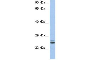 RAB15 antibody used at 1 ug/ml to detect target protein. (RAB15 anticorps  (N-Term))