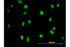 Immunofluorescence of monoclonal antibody to MPG on HeLa cell. (MPG anticorps  (AA 1-90))
