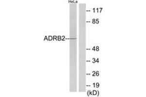 Western blot analysis of extracts from HeLa cells, using ADRB2 Antibody. (beta 2 Adrenergic Receptor anticorps  (AA 201-250))