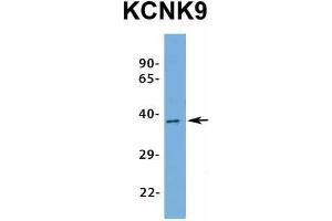 Host:  Rabbit  Target Name:  KCNK9  Sample Type:  Human Fetal Brain  Antibody Dilution:  1. (KCNK9 anticorps  (N-Term))