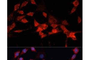 Immunofluorescence analysis of NIH-3T3 cells using DDB1 Polyclonal Antibody at dilution of 1:100 (40x lens). (DDB1 anticorps)