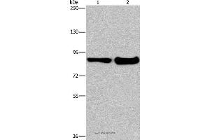 Western blot analysis of Mouse lung and liver tissue, using ECE1 Polyclonal Antibody at dilution of 1:1050 (MAPRE3 anticorps)