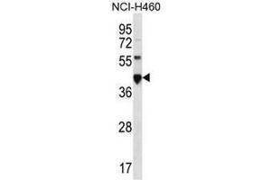 CEACAM18 Antibody (N-term) western blot analysis in NCI-H460 cell line lysates (35µg/lane). (CEACAM18 anticorps  (N-Term))