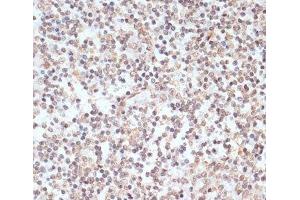 Immunohistochemistry of paraffin-embedded Human tonsil using Phospho-ERK1(T202/Y204)/ ERK2(T185/Y187) Polyclonal Antibody at dilution of 1:100 (40x lens).