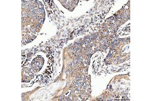 IHC analysis of MUT using anti-MUT antibody (ABIN4886676). (MUT anticorps  (N-Term))