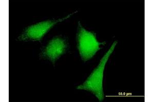 Immunofluorescence of purified MaxPab rabbit antibody to MAP2K2 on HeLa cell. (MEK2 anticorps  (AA 1-400))