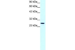WB Suggested Anti-CLDN13 Antibody Titration:  1. (Claudin 13 (CLDN13) (C-Term) anticorps)