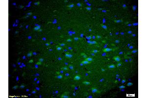 Formalin-fixed and paraffin embedded rat brain labeled with Anti GRM5/mGluR5 Polyclonal Antibody, Unconjugated (ABIN673914) at 1:200 followed by conjugation to the secondary antibody Goat Anti-Rabbit IgG, FITC conjugated used at 1:200 dilution for 40 minutes at 37°C and DAPI staining. (Metabotropic Glutamate Receptor 5 anticorps  (AA 201-300))