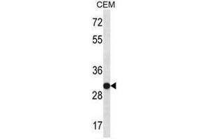 SNRPA Antibody (Center) western blot analysis in CEM cell line lysates (35µg/lane). (SNRPA1 anticorps  (Middle Region))
