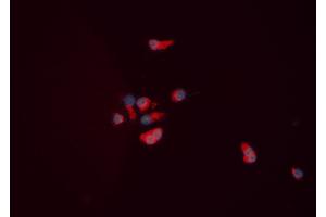 ABIN6276063 staining HEPG2 cells by ICC/IF. (NPY5R anticorps  (Internal Region))