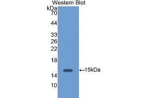 Western Blotting (WB) image for anti-Hexosaminidase B (Beta Polypeptide) (HEXB) (AA 101-217) antibody (ABIN1859139) (HEXB anticorps  (AA 101-217))