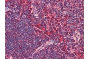 Image no. 1 for anti-Chemokine (C-X-C Motif) Receptor 6 (CXCR6) antibody (ABIN372833) (CXCR6 anticorps)