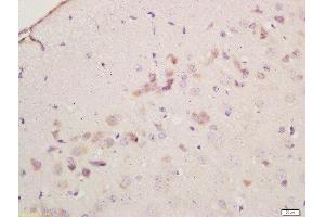 Formalin-fixed and paraffin embedded mouse brain labeled with Anti-Cyclooxygenase-2 Polyclonal Antibody, Unconjugated  at 1:200 followed by conjugation to the secondary antibody and DAB staining (PTGS2 anticorps  (AA 301-400))