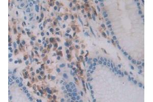 DAB staining on IHC-P; Samples: Human Stomach Tissue (Chemerin anticorps  (AA 33-158))