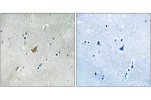 Immunohistochemistry analysis of paraffin-embedded human brain, using EPHA3/4/5 (Phospho-Tyr779/833) Antibody. (EPH Receptor A3 anticorps  (pTyr779))