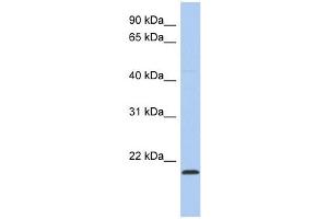 RWDD4A antibody used at 1 ug/ml to detect target protein. (RWDD4A anticorps  (Middle Region))
