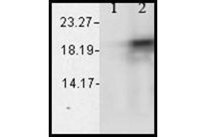 Western blot analysis of Alpha B Crystallin showing its absolte specificity. (CRYAB Kit ELISA)