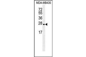 Western blot analysis of LIN28 Antibody  in MDA-MB435 cell line lysates (35ug/lane). (LIN28A anticorps)