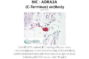 Image no. 1 for anti-Alpha-2A Adrenergic Receptor (ADRA2A) antibody (ABIN1731578) (ADRA2A anticorps)