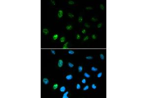 Immunofluorescence analysis of HepG2 cell using CGA antibody. (CGA anticorps)