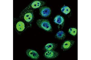 Immunofluorescence (IF) image for anti-SMAD Family Member 4 (SMAD4) (pThr277) antibody (ABIN3001788) (SMAD4 anticorps  (pThr277))