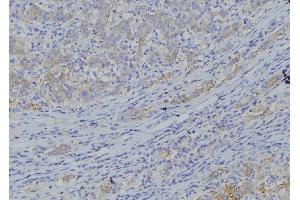 ABIN6277564 at 1/100 staining Human gastric tissue by IHC-P. (CYB5A anticorps  (Internal Region))