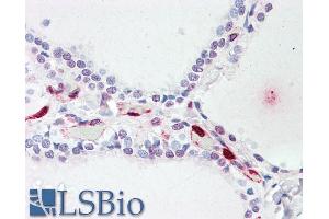 ABIN238640 (5µg/ml) staining of paraffin embedded Human Thyroid. (ATP13A1 anticorps  (Internal Region))