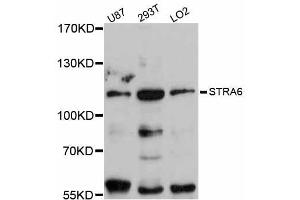 Western blot analysis of extracts of various cell lines, using STRA6 antibody (ABIN5998994) at 1:3000 dilution. (STRA6 anticorps)