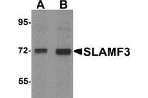 Western blot analysis of SLAMF3 / CD229 in 293 cell lysate with SLAMF3 antibody at (A) 1 and (B) 2 μg/ml. (LY9 anticorps  (C-Term))