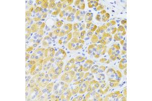 Immunohistochemistry of paraffin-embedded rat kidney using FAS Antibody (ABIN5970062) at dilution of 1/100 (40x lens). (FAS anticorps)