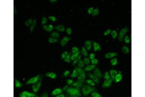 Figure:FITC staining on IHC-P Simple: Hela cells (SHMT2 anticorps  (AA 30-504))