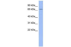 WB Suggested Anti-ZNF133 Antibody Titration:  0. (ZNF133 anticorps  (Middle Region))