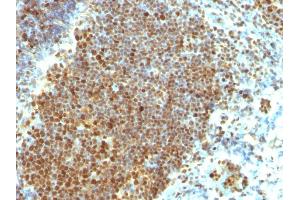 Formalin-fixed, paraffin-embedded human Tonsil stained with PCNA Monoclonal Antibody (PCNA/694) (PCNA anticorps)