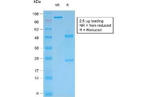 anti-Cytokeratin, Multi (Epithelial Marker) antibody