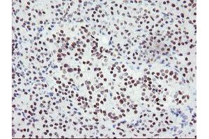 Image no. 11 for anti-SUMO1/sentrin/SMT3 Specific Peptidase 2 (SENP2) (AA 139-523) antibody (ABIN1490925)