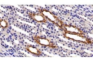 Detection of CK7 in Rat Kidney Tissue using Polyclonal Antibody to Cytokeratin 7 (CK7) (Cytokeratin 7 anticorps  (AA 91-394))