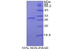 SDS-PAGE analysis of Human Protocadherin beta 2 Protein. (PCDHb2 Protéine)