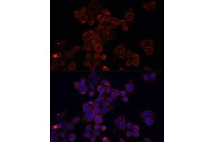 Immunofluorescence analysis of HeLa cells using MTOR antibody (ABIN6292920) at dilution of 1:100.