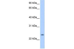 WB Suggested Anti-PQLC1 Antibody Titration:  0.
