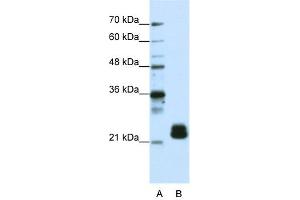 WB Suggested Anti-TMED4 Antibody Titration:  1. (TMED4 anticorps  (N-Term))