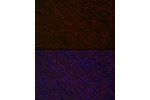 Immunofluorescence analysis of rat heart using Desminmin Rabbit pAb (ABIN3021114, ABIN3021115, ABIN3021116 and ABIN6213957) at dilution of 1:100 (40x lens).