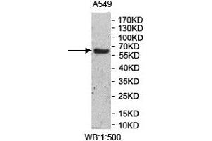 Western Blotting (WB) image for anti-UDP Glucuronosyltransferase 2 Family, Polypeptide A3 (UGT2A3) antibody (ABIN1856379) (UGT2A3 anticorps)