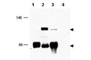 Western blot using  affinity purified anti-MECT1 antibody shows detection of endogenous MECT1 (lower arrowhead) and MECT1-MAML2 fusion protein (top arrowhead) in cell lysates. (CRTC1 anticorps  (AA 19-34))